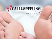 Calluspeeling